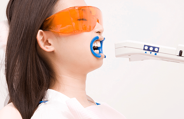 オフィスホワイトニングのイメージ