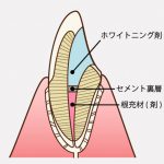 失活し