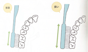 松山市　歯医者　歯ブラシの形態　松友歯科クリニック
