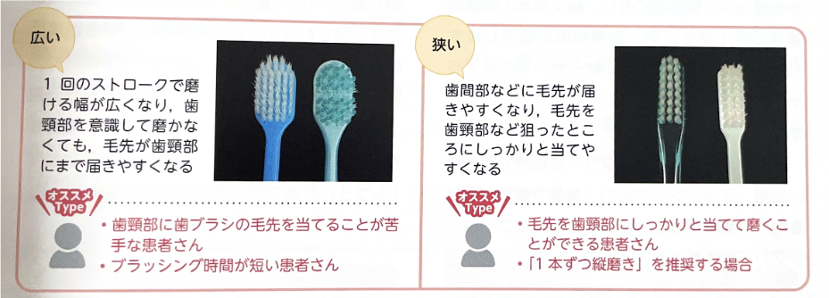 松山市　歯医者　歯ブラシの形態　松友歯科クリニック