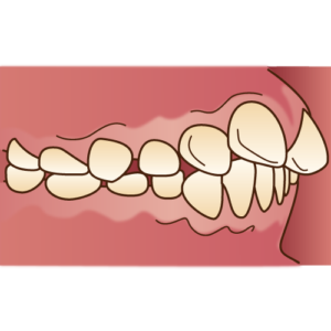 松山市　歯医者　かみ合わせ　松友歯科クリニック