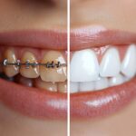 審美治療の前後のイメージ