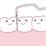 歯周ポケット検査