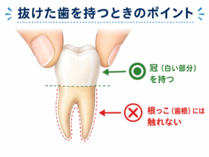 抜けた歯を持つときのポイント