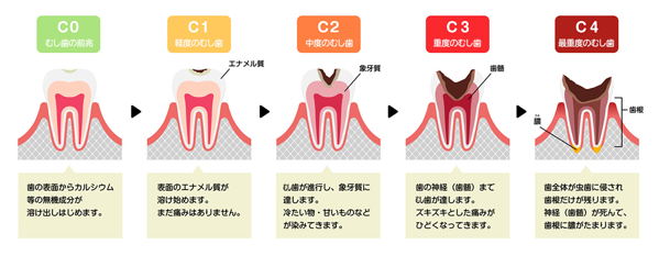 c0-c4の説明図