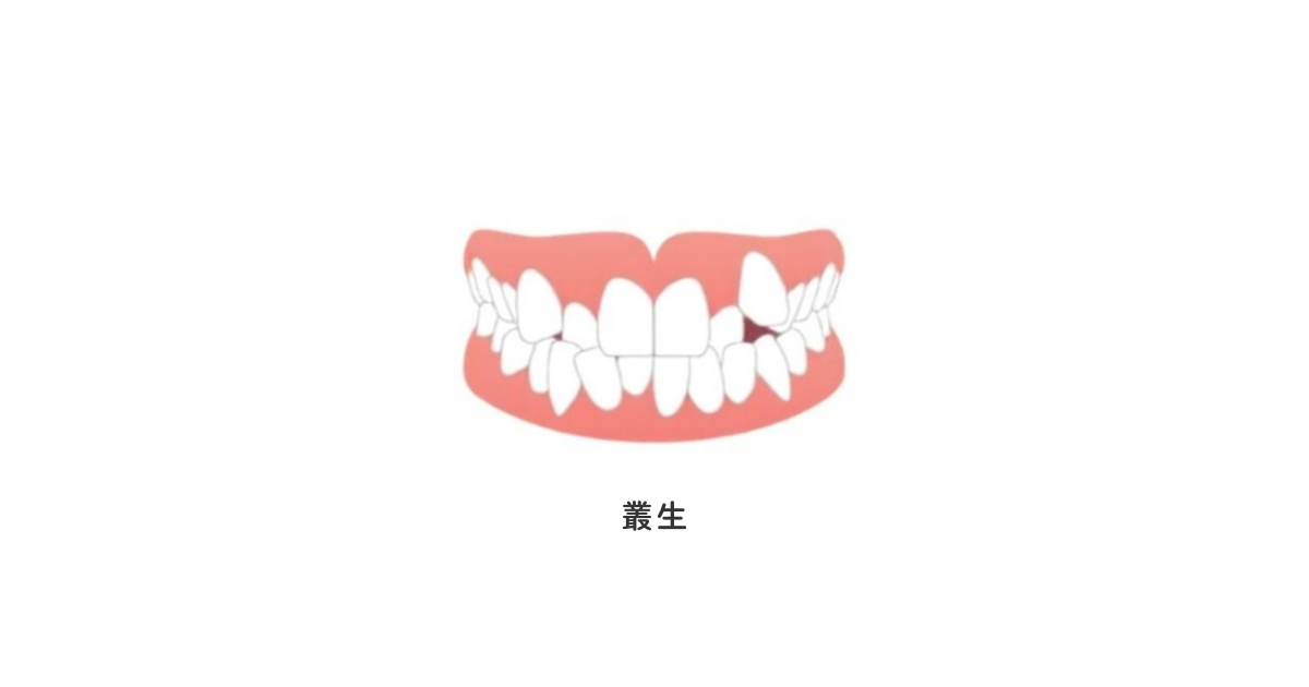 叢生