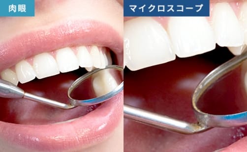 肉眼とマイクロスコープの比較イメージ